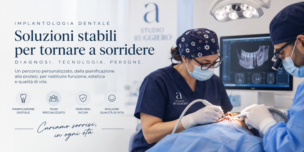 Implantologia dentale presso lo Studio Odontoiatrico Ruggiero a Fuscaldo